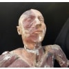 Flayed Auzoux Type, XIXth, Plaster, scale 1:1 20